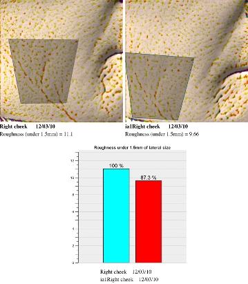 3D report